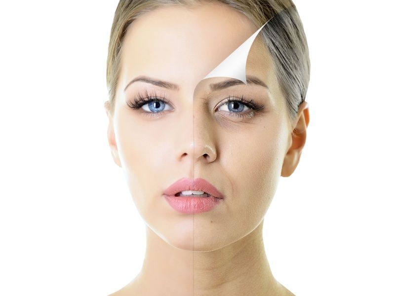 ameliyatsiz-yuz-germe-yontemleri-kimlere-yapilir