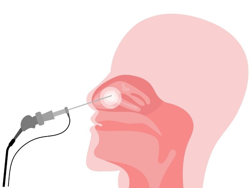 fess-hangi-durumlarda-gereklidir
