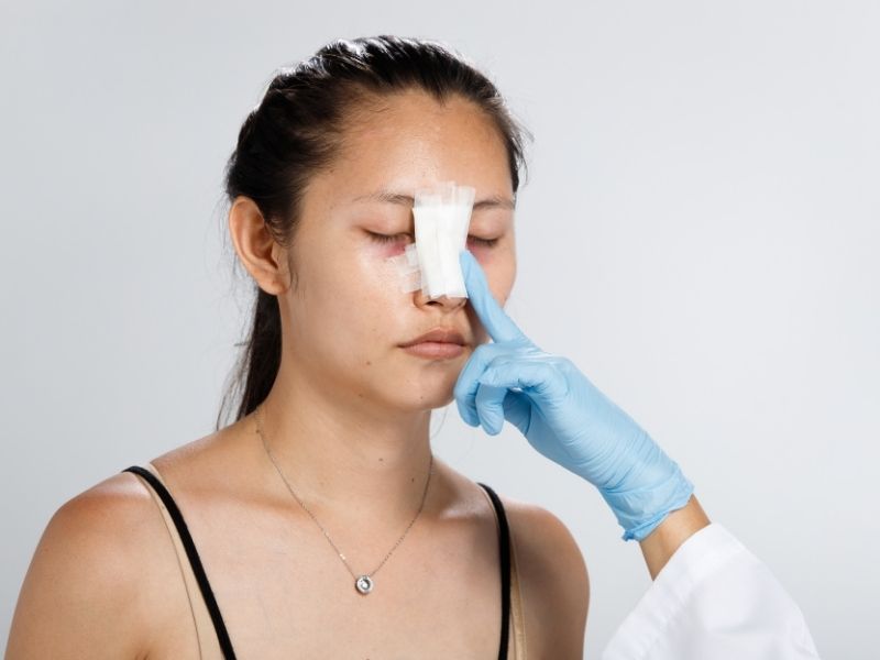 /revizyon-rinoplastide-neden-tampon-kullanilir