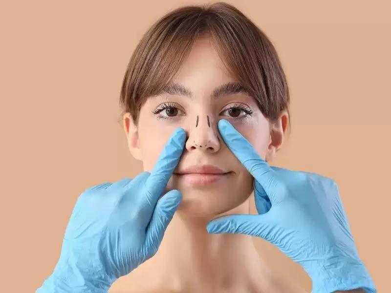 burun-estetigi-rinoplasti-nedir