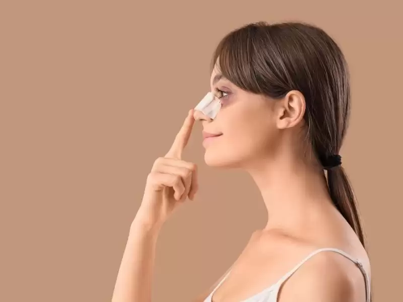 revizyon-rinoplasti-morarma-ve-odem-ne-kadar-surer