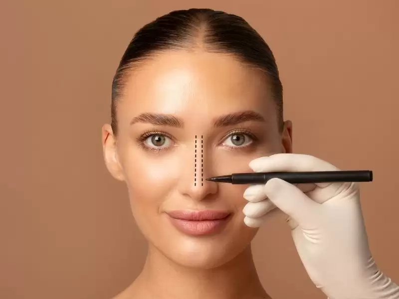 revizyon-rinoplasti-turkiye-nin-tercih-edilme-nedenleri