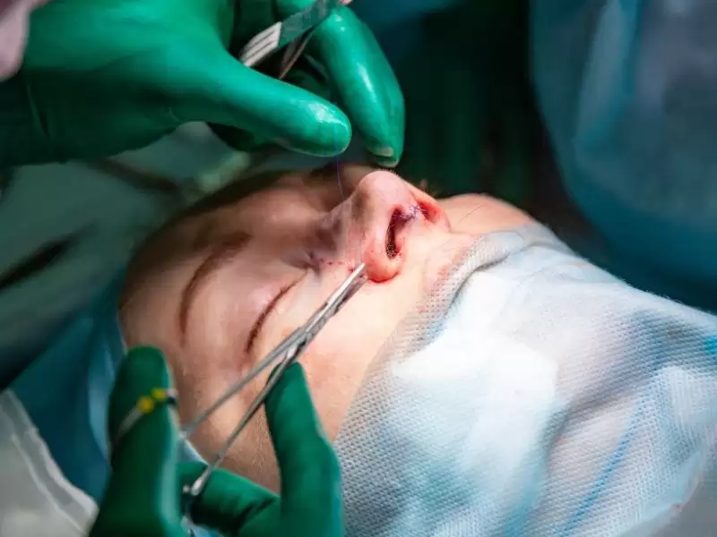 revizyon-rinoplastide-kullanilan-greftler