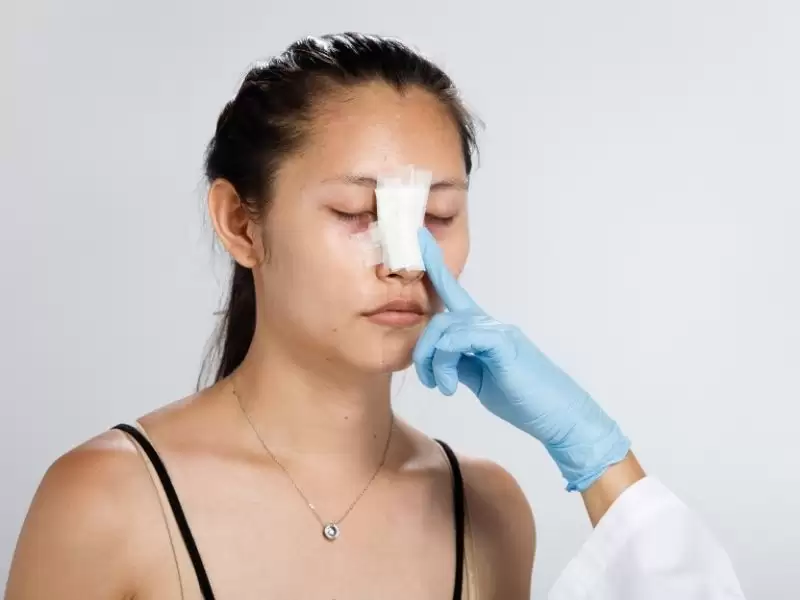 revizyon-burun-estetiginde-tampon-kac-gun-kalir