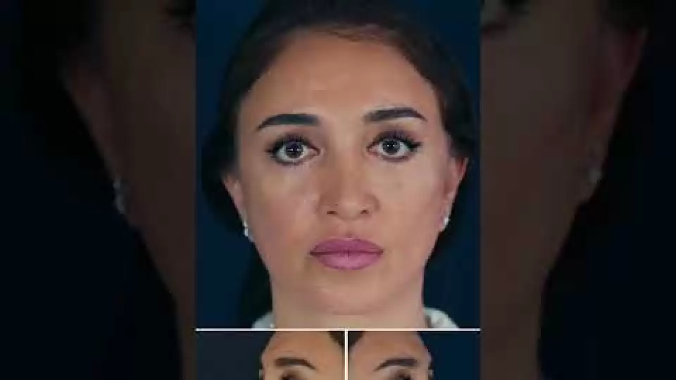 video,paylaşım,kameralı telefon,videofon,ücretsiz,yükleme