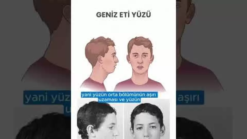 video,paylaşım,kameralı telefon,videofon,ücretsiz,yükleme