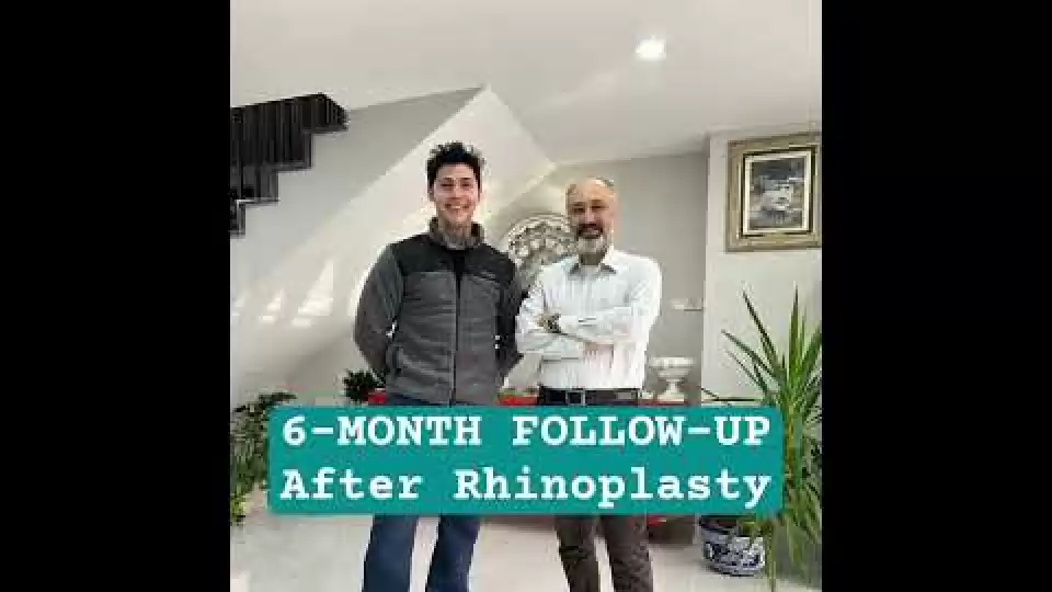 video,paylaşım,kameralı telefon,videofon,ücretsiz,yükleme