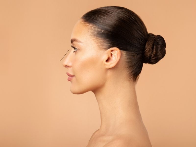 yuz-oranlarina-uyumlu-burun-estetigi