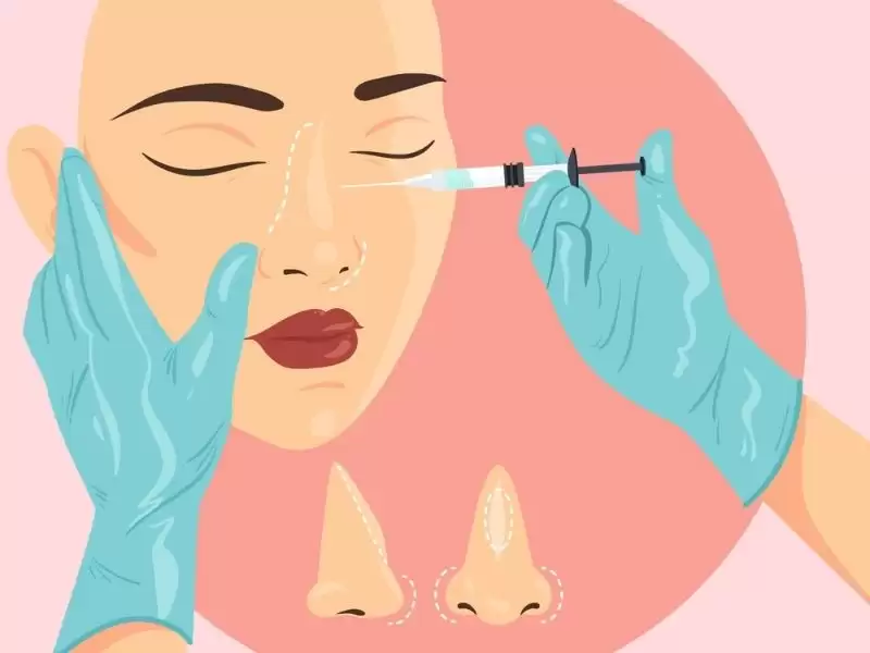 rinoplasti-ile-asimetrik-burun-deliklerinin-duzeltilmesi