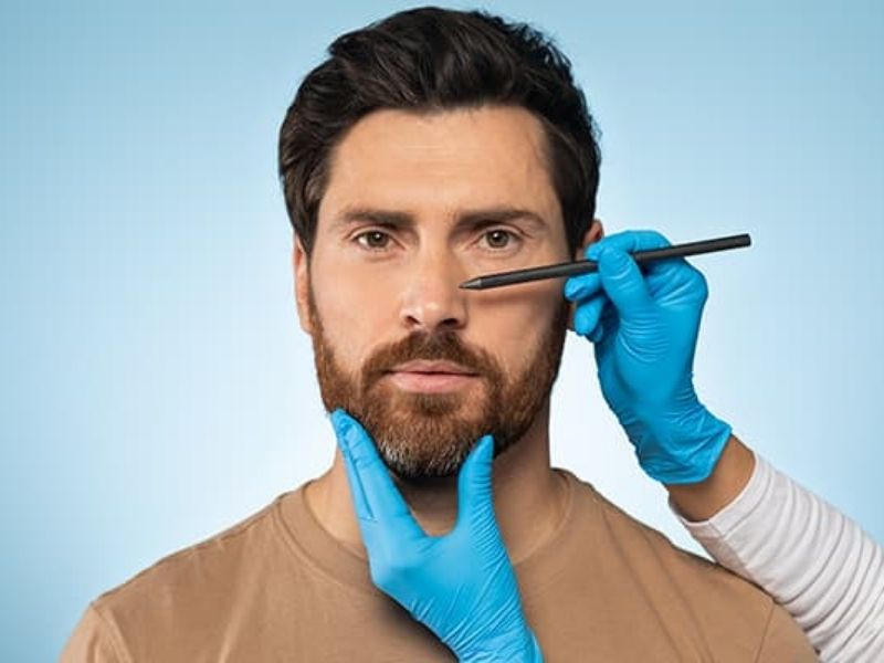 erkek-rinoplastisinin-temel-yaklasimi