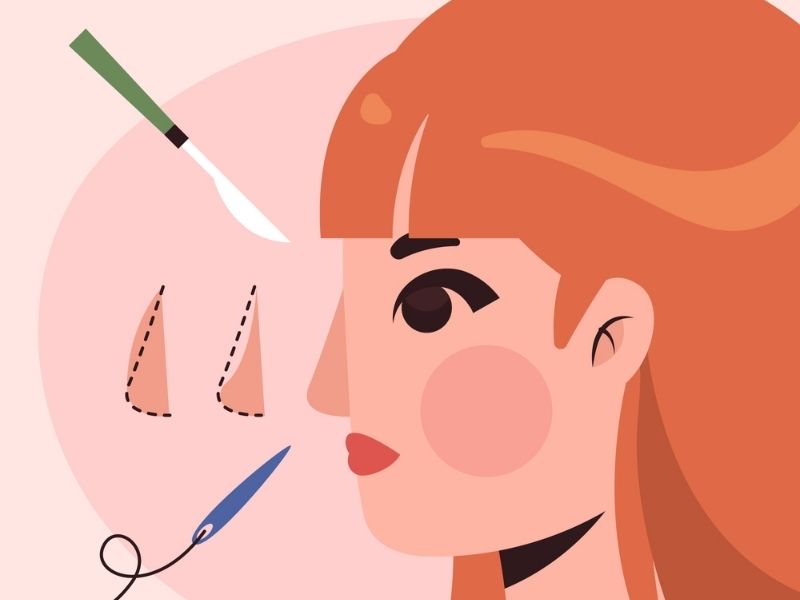 rinoplasti-ile-burun-deligi-asimetrisi-nasil-duzeltilir