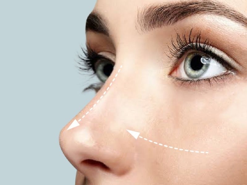 rinoplasti-oncesi-muayene-nedir