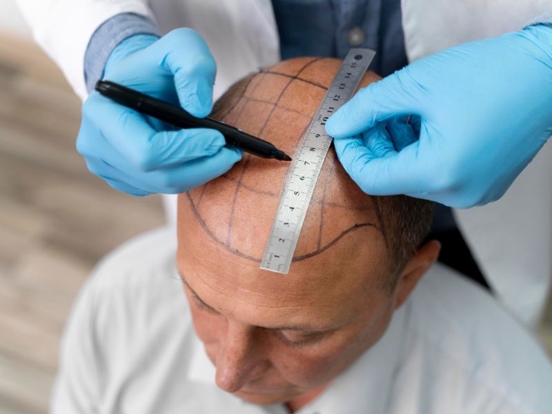 sinuzit-ameliyati-nedir