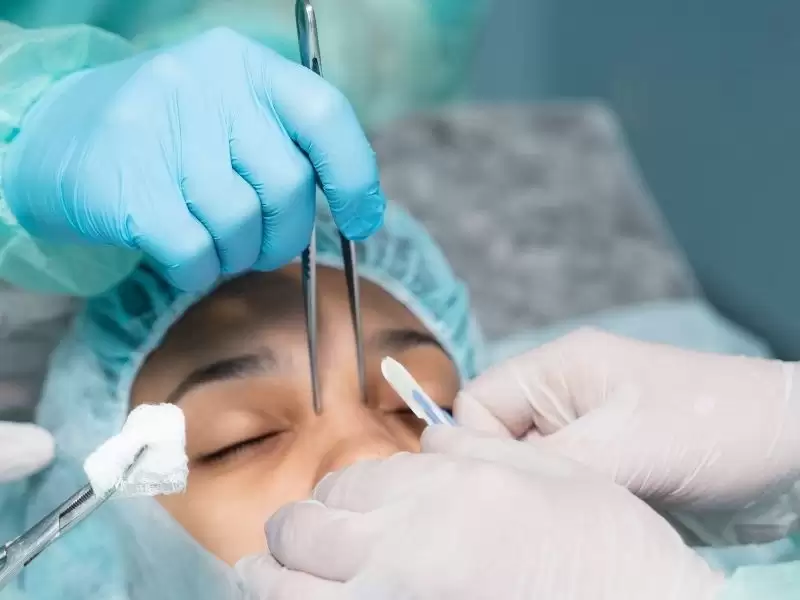 burun-estetigi-rinoplasti-ameliyatinda-burun-kemikler-kirilir-mi