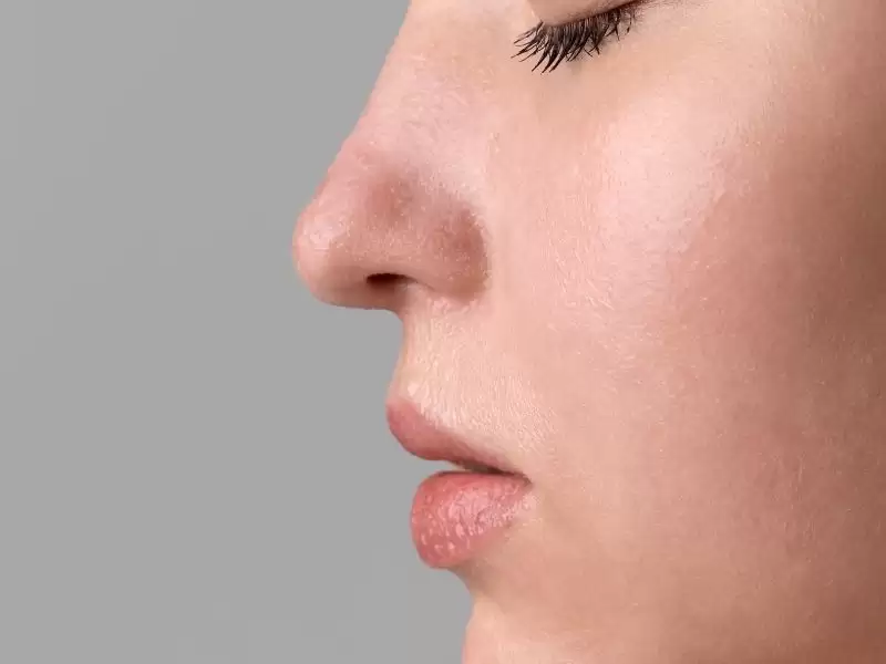 burun-estetiginde-dogal-burun-estetigi-ne-demektir