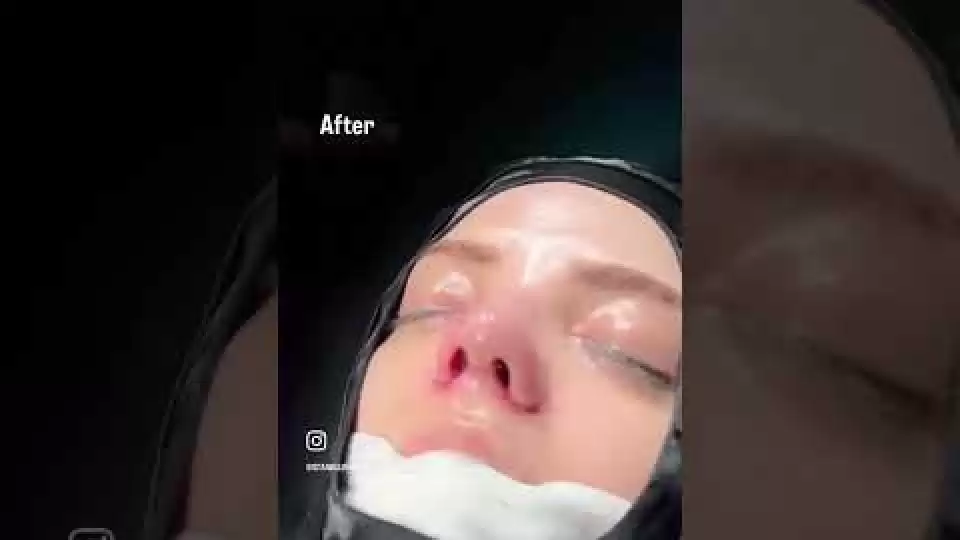 video,paylaşım,kameralı telefon,videofon,ücretsiz,yükleme