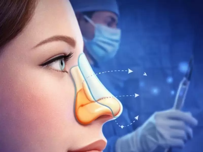 turkiye-de-rinoplasti-ameliyati-nedir