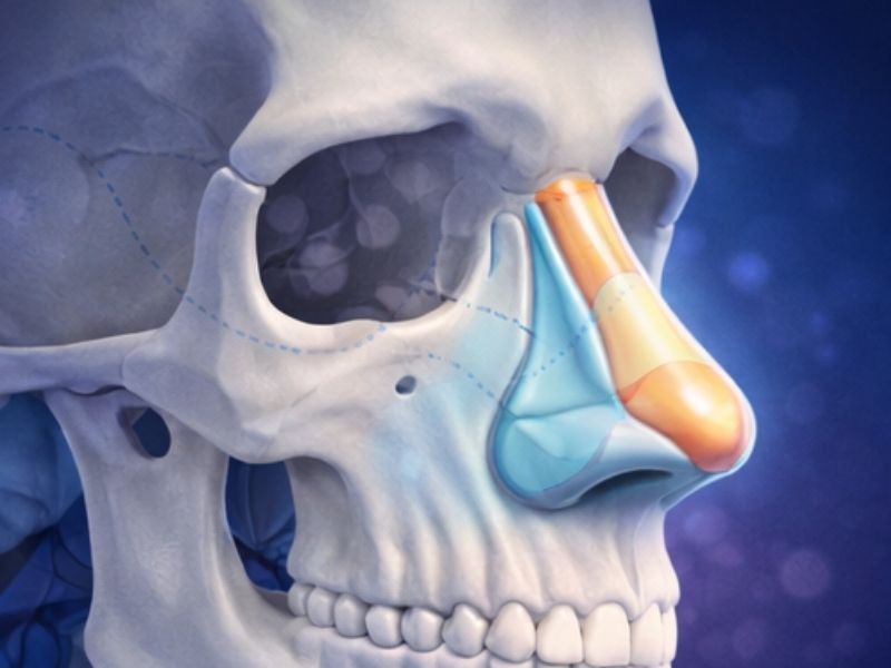 closed-rhinoplasty-technique-in-turkey