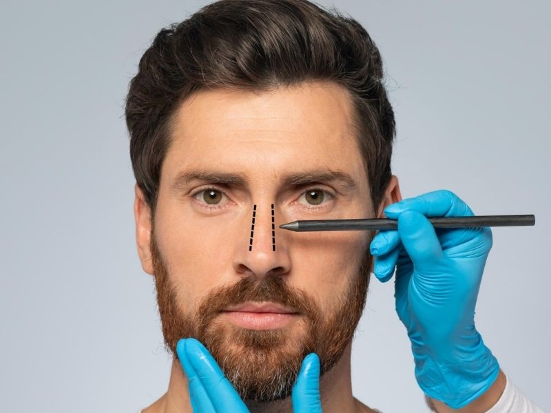 erkek-burun-estetigi-sonrasi-iyilesme-sureci