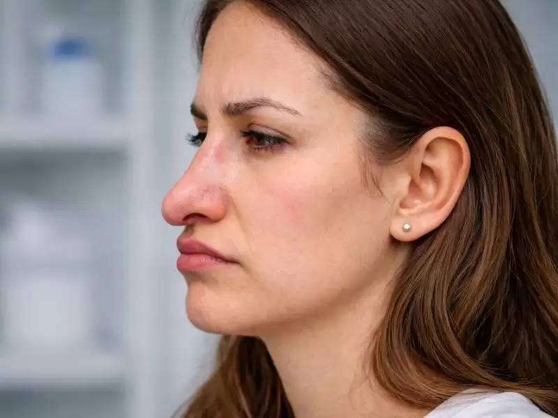 basarisiz-burun-estetigi