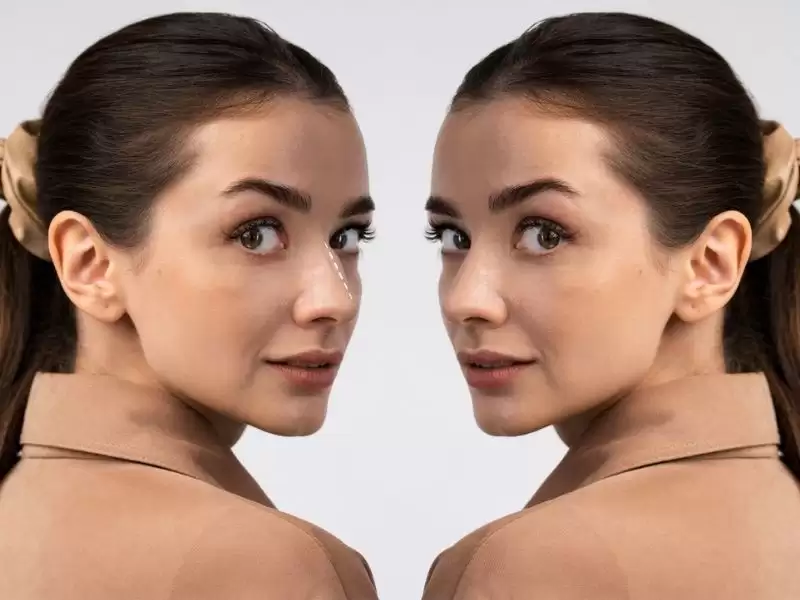 gercek-hasta-paylasimlari