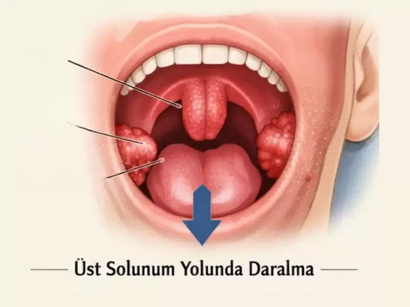 uppp-ameliyati-yapan-doktorlar-neye-dikkat-eder