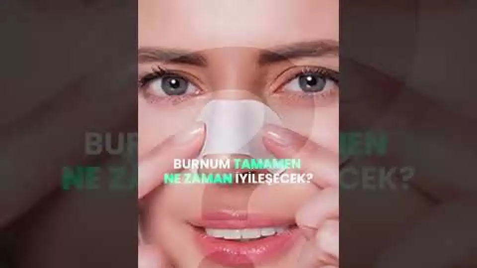 Burun Estetiği,Rinoplasti