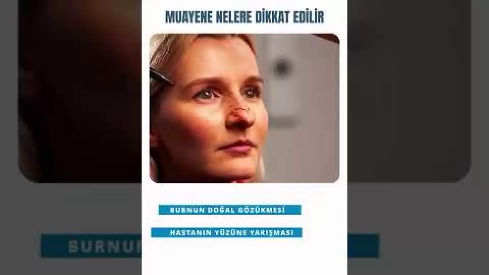 Rinoplasti,Burun Estetiği