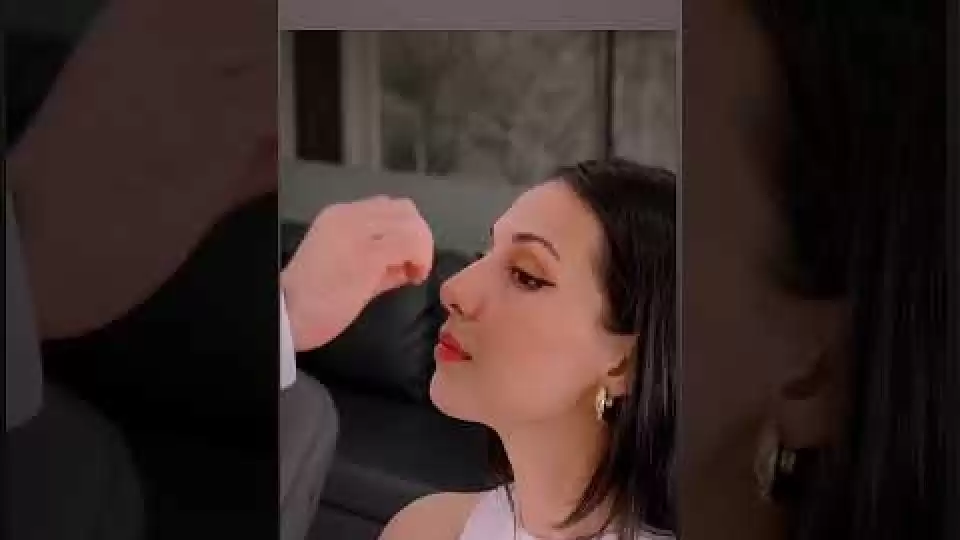 Rinoplasti,Burun Estetiği