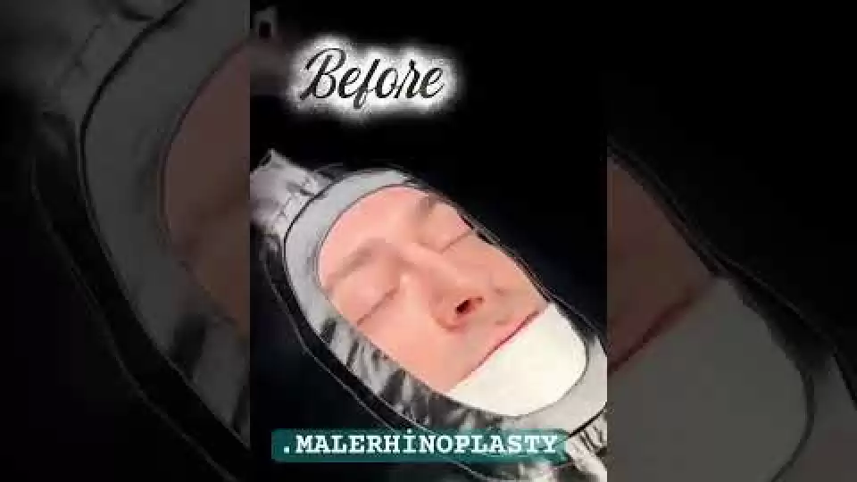 video,paylaşım,kameralı telefon,videofon,ücretsiz,yükleme