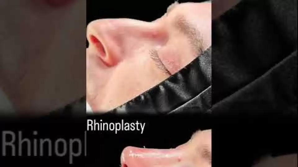 video,paylaşım,kameralı telefon,videofon,ücretsiz,yükleme