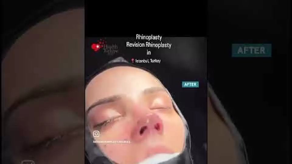 video,paylaşım,kameralı telefon,videofon,ücretsiz,yükleme