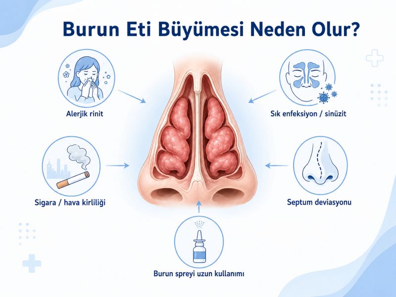 burun-eti-buyumesi-neden-olur