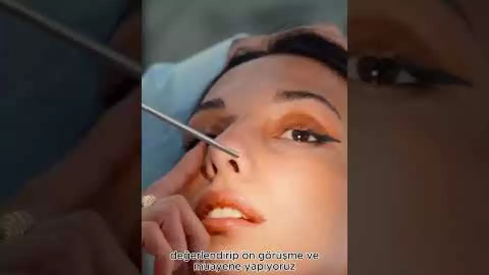 video,paylaşım,kameralı telefon,videofon,ücretsiz,yükleme